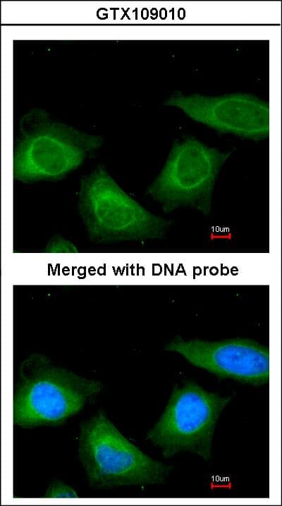 SERPINA7 / TBG Antibody (aa1-371)
