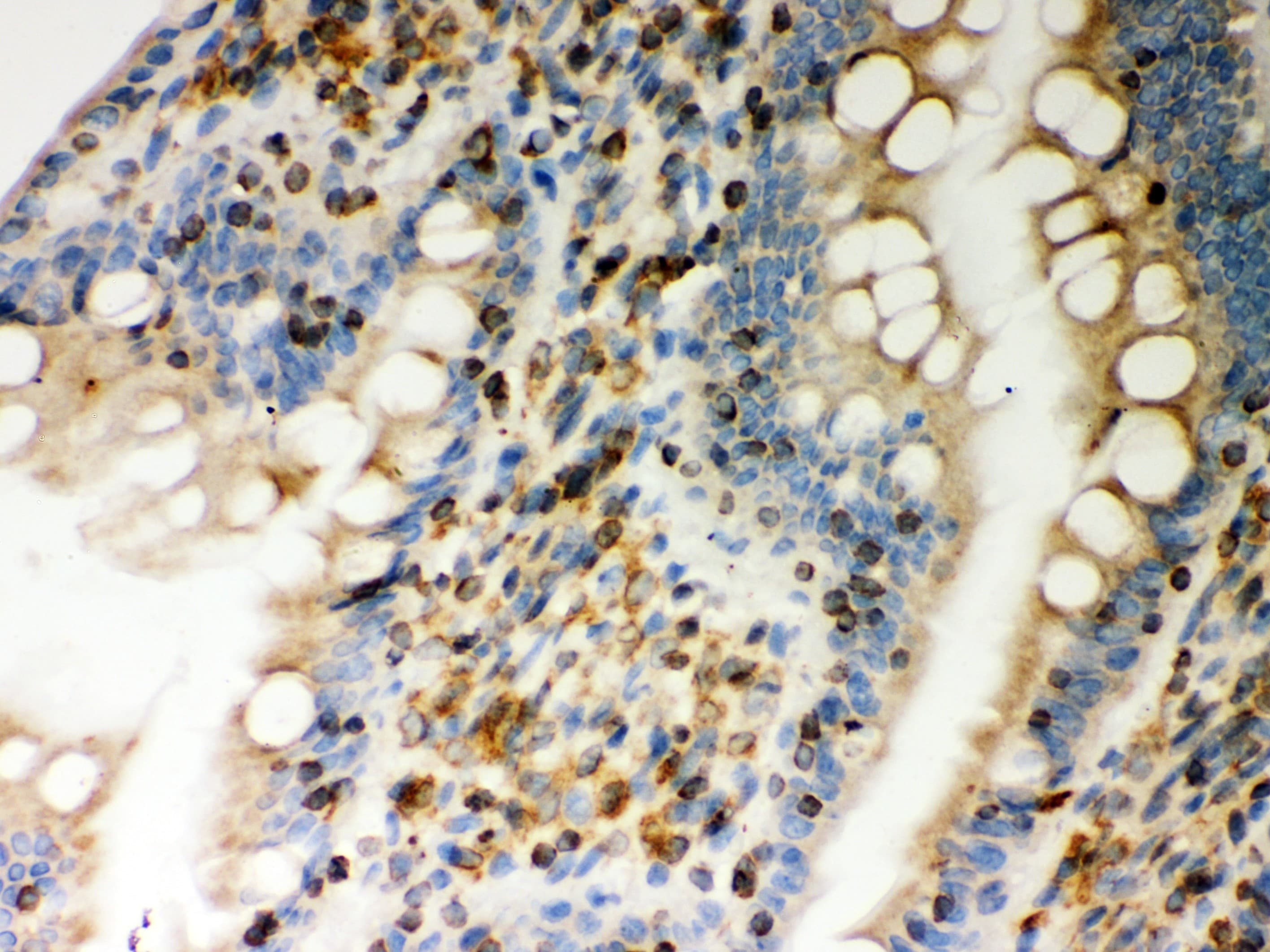 GOK / STIM1 Antibody (aa45-74)