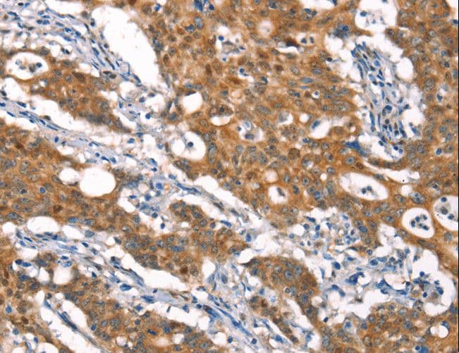 CYLD Antibody