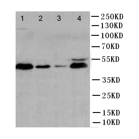 CASP1 / Caspase 1 Antibody (aa135-152)