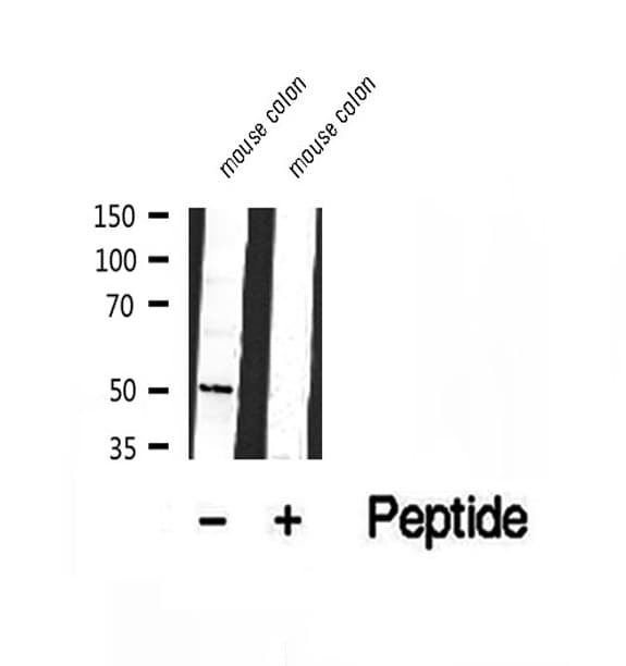CHKA / CK / Choline Kinase Antibody
