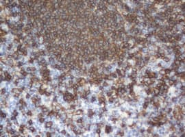 CD20 Antibody (clone OTI10A5)