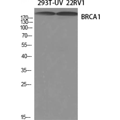 BRCA1 Antibody (1360-1440 aa)
