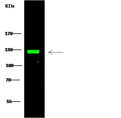 TRIM37 / TEF3 Antibody (Preservative Free)