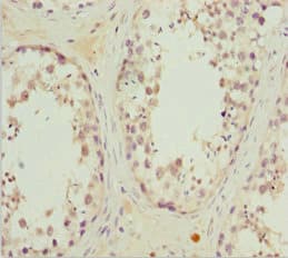 MRAS Antibody
