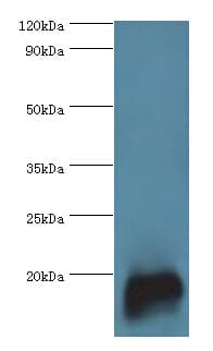 IHC-plus™ Polyclonal Rabbit anti-Human TNNC2 Antibody (aa1-160, IHC, WB)