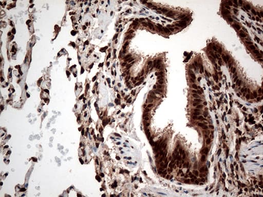 CDK15 / ALS2CR7 Antibody (aa293-378, clone OTI1E1)