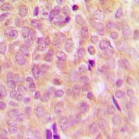 MAP3K5 / ASK1 Antibody (N-Terminus)