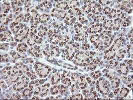 RAB21 Antibody (clone OTI6G1)