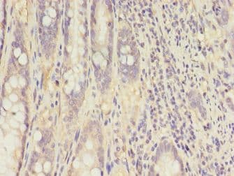 CKB / Creatine Kinase BB Antibody (aa2-270)
