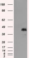 Monoclonal Mouse anti-Human MCL1 / MCL 1 Antibody (clone OTI9C9, IHC, IF, WB)