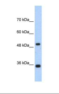 FBP1 Antibody (aa114-163)