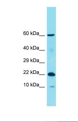 C11orf87 Antibody (aa99-148)