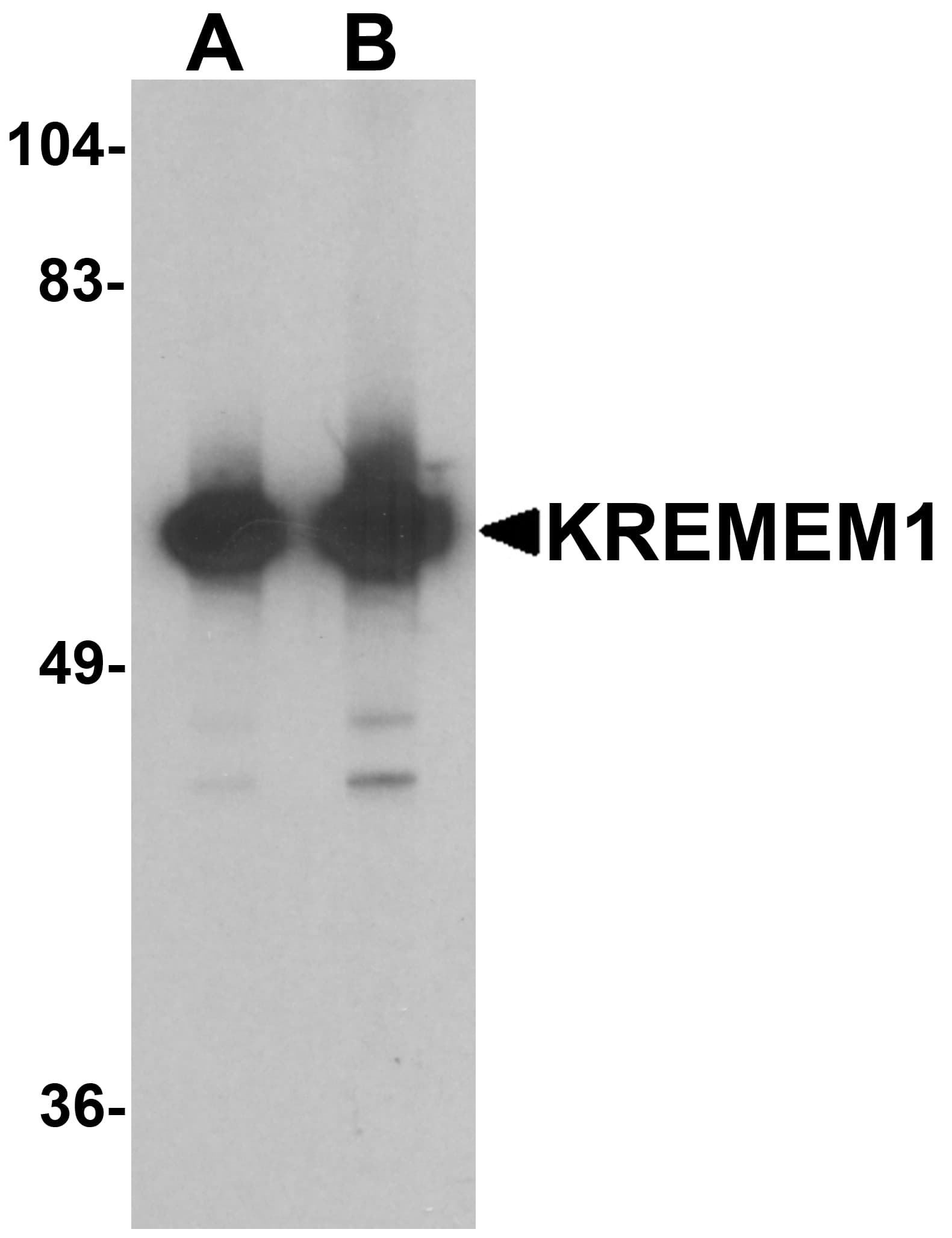 IHC-plus™ KREMEN1 / KREMEN-1 Antibody