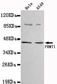 PRMT1 Antibody