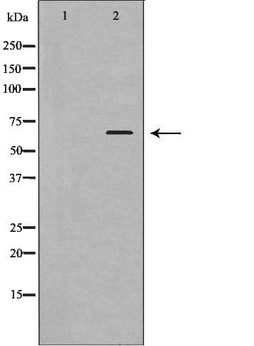 OPTN / Optineurin Antibody