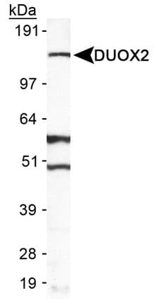 Polyclonal Rabbit anti-Human DUOX2 Antibody (Biotin, Internal, WB)