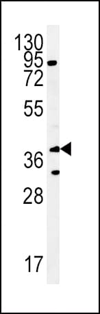SLC10A1 / NTCP Antibody (aa316-343)