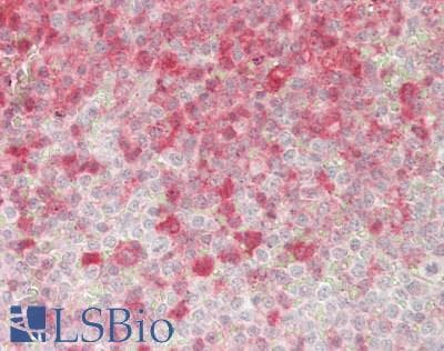 IHC-plus™ STK10 / LOK Antibody (aa481-530)