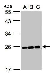 Polyclonal Rabbit anti-Human MAD2L1 / MAD2 Antibody (aa142-205, IHC, WB)