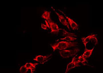 GRIN2B / NMDAR2B / NR2B Antibody (phospho-Tyr1474)