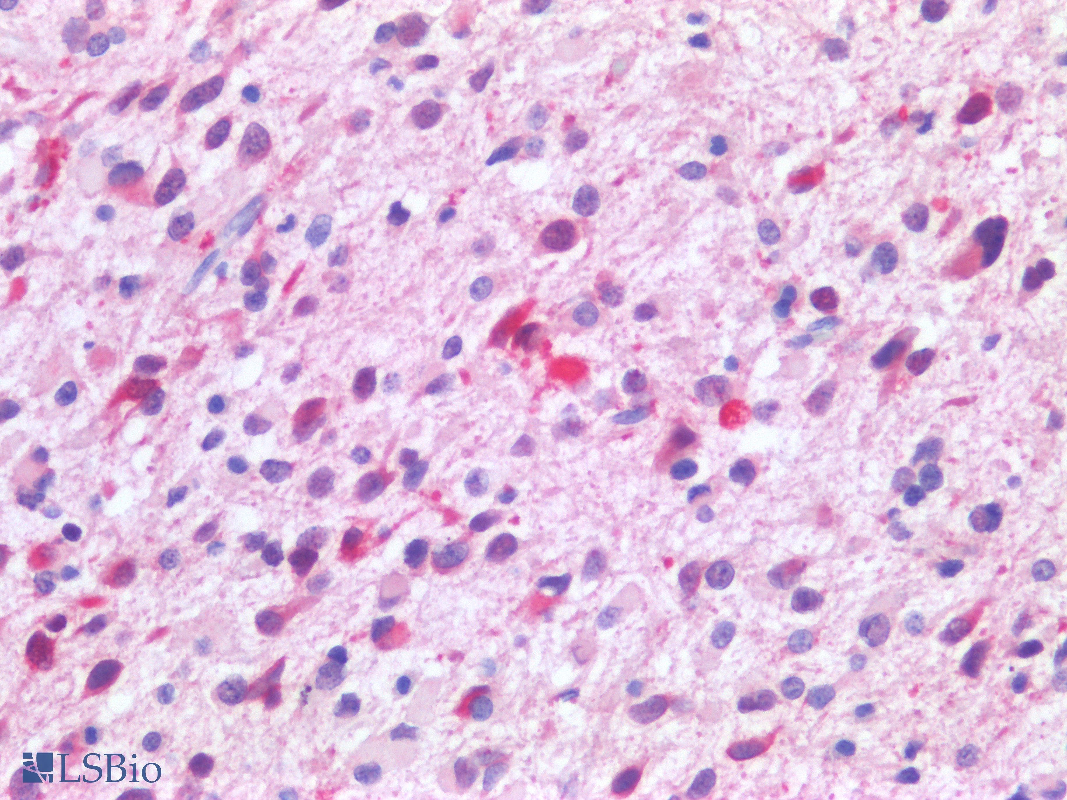 PathPlus™ Isocitrate Dehydrogenase R132H Mutant Antibody (Mutation R132H, Concentrated)