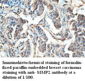 Polyclonal Rabbit anti-Human MMP2 Antibody (IHC, WB)