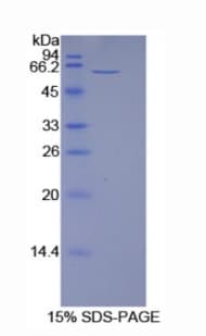 Rat NT5E / eNT / CD73 Protein (Recombinant His)