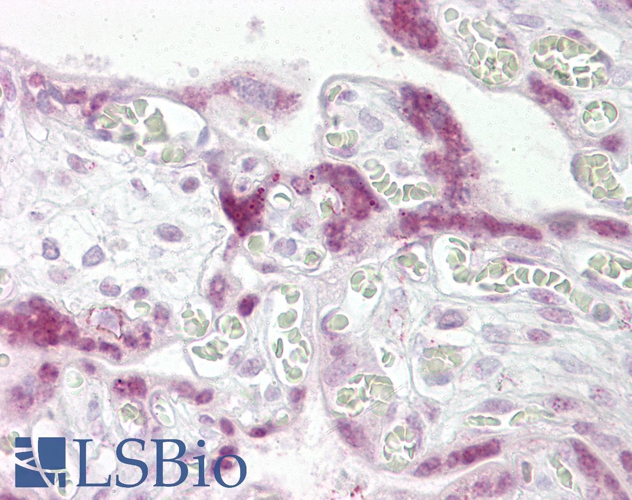 IHC-plus™ TWIST1 / TWIST Antibody (N-Terminus)