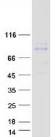 Human RHOBTB1 Protein (Recombinant Myc-DDK (Flag))