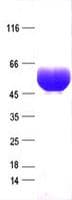 Human SERPINB3 Protein (Recombinant His, N-Terminal)