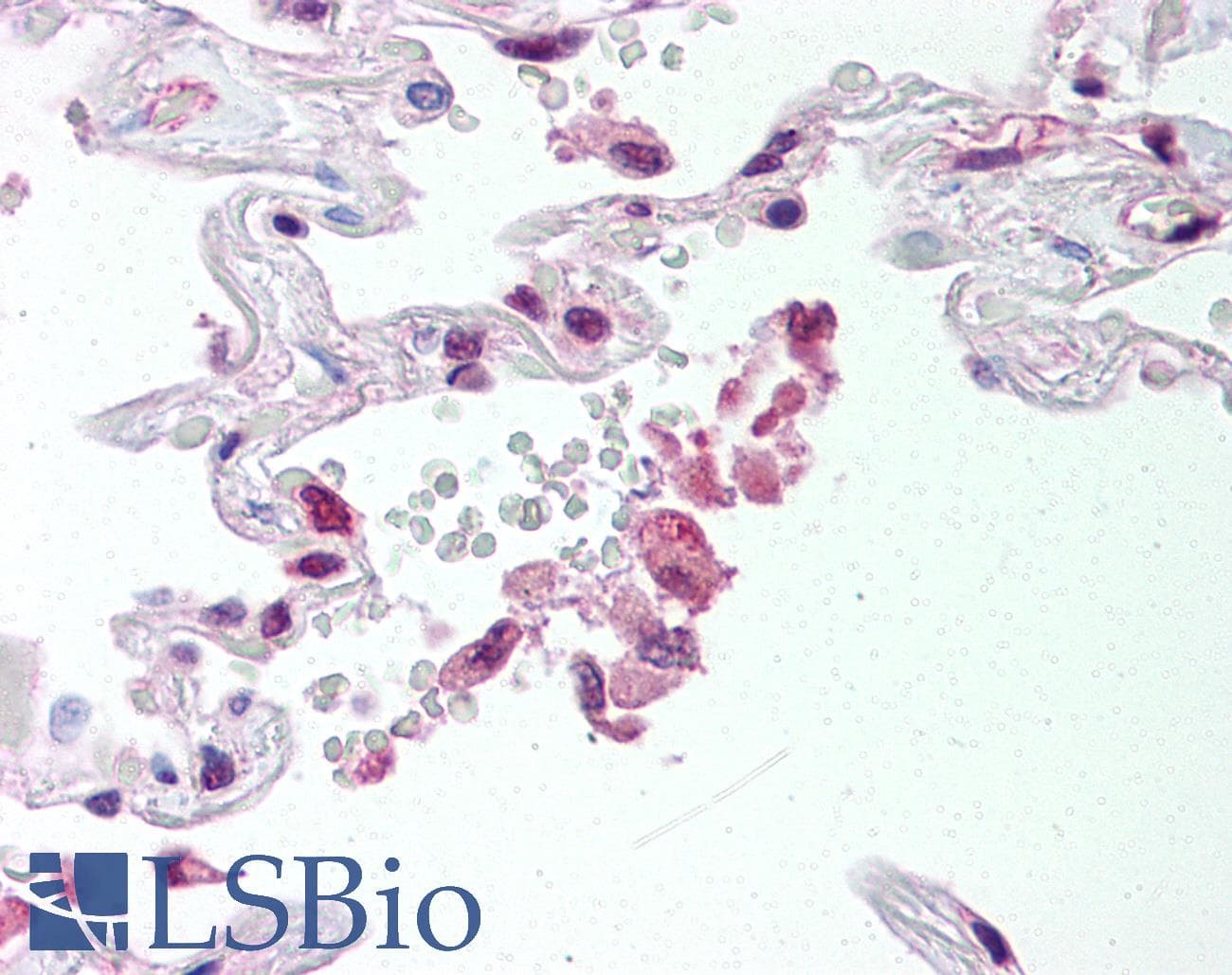 ABCG1 Antibody (Internal, DY650)