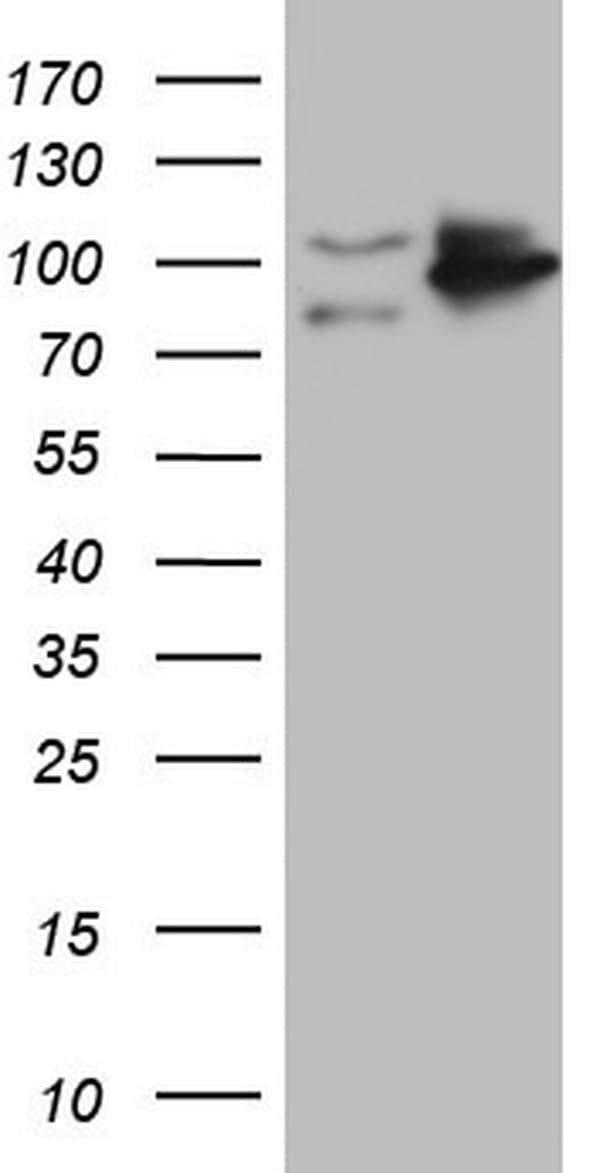 TLK2 Antibody (aa1-296, clone OTI2C1)