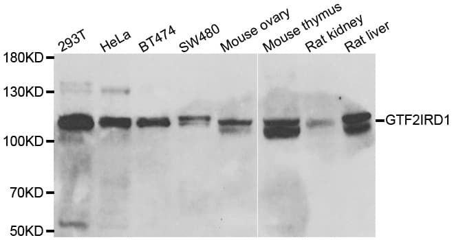 Polyclonal Rabbit anti-Human GTF3 / GTF2IRD1 Antibody (IHC, WB)