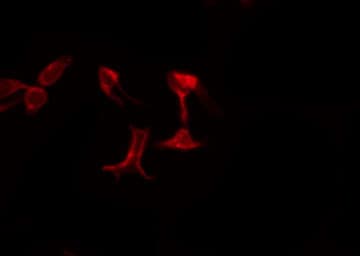 AGPAT5 Antibody