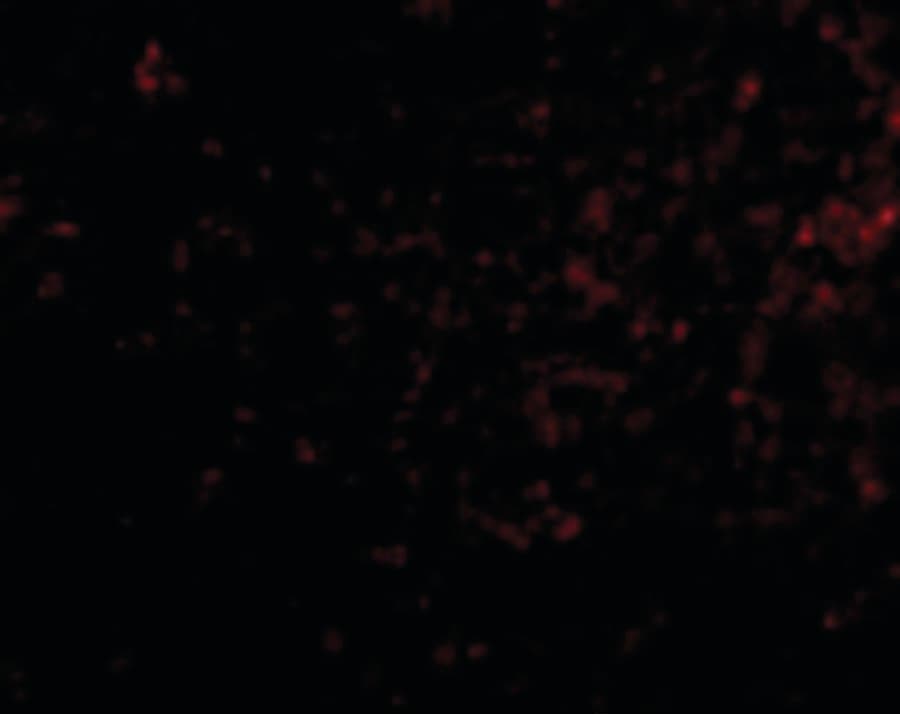IHC-plus™ GRIK4 / KA1 Antibody
