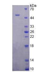 Human SFTPB / Surfactant Protein B (Recombinant His-GST, N-terminus)