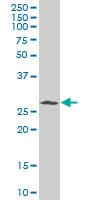 CDK5 Antibody (clone 1A2)