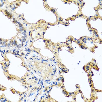 IHC-plus™ Polyclonal Rabbit anti-Human PIP / GCDFP-15 Antibody (IHC, IF)