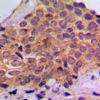 Polyclonal Rabbit anti-Human RPS6KB1 / P70S6K / S6K Antibody (phospho-Ser434, IHC, IF, WB)
