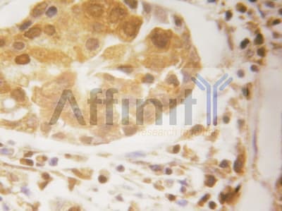 Polyclonal Rabbit anti-Human BIRC5 / Survivin Antibody (IHC, IF, WB)