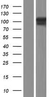 Human TPO / Thyroid Peroxidase Protein (Over-Expression Lysate Myc-DDK (Flag))
