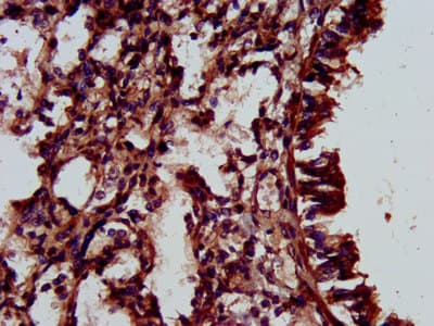 ELMOD3 Antibody