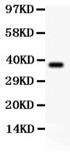 SLC9A1 / NHE1 Antibody (aa543-815)