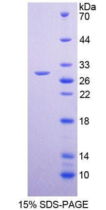 Human SLC12A7 / KCC4 Protein (Recombinant His-T7)