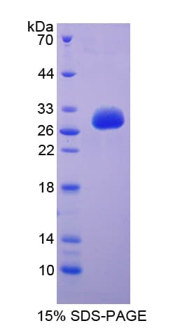 Human CD101 Protein (Recombinant His-T7)
