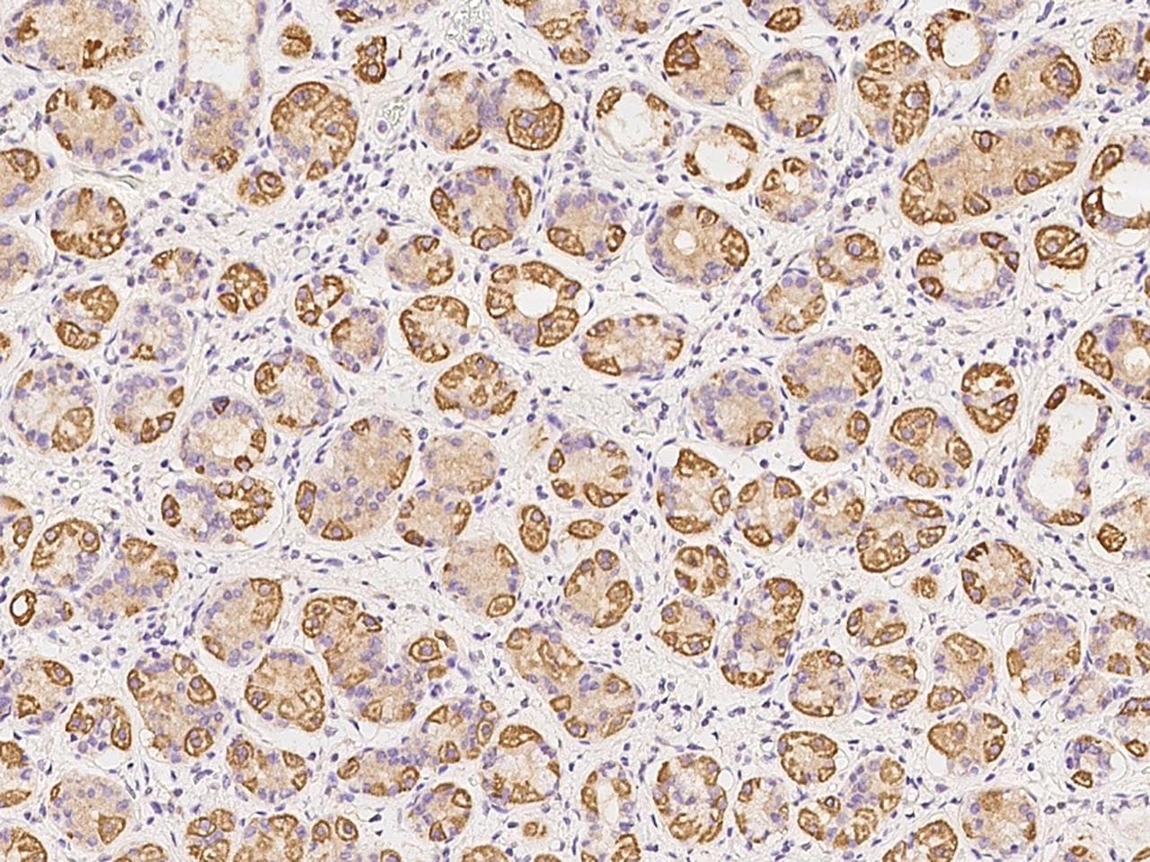 HSPC176 / TRAPPC2L Antibody