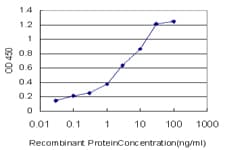 IHC-plus™ SIRT1 / Sirtuin 1 Antibody (clone 7B7)