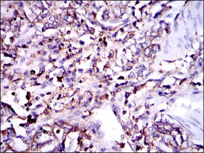 G6PD Antibody (clone 5E+12)
