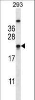 TAGLN2 / Transgelin 2 Antibody (aa136-165)